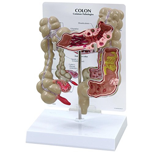 GPI Anatomicals W33364 Dickdarm Modell von 3B Scientific