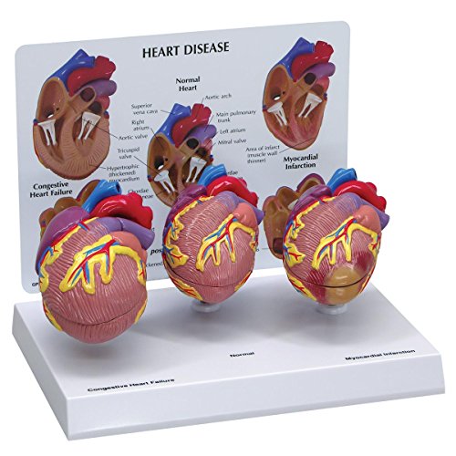 GPI Anatomicals W33365 Herz Modell mini Set GPI Anatomicals W33365 Herz Modell mini Set von GPI Anatomicals