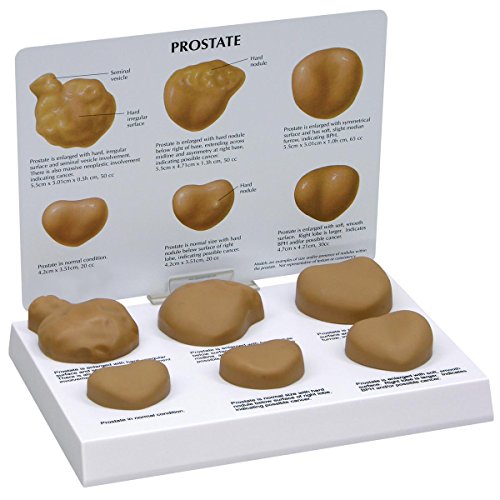 GPI Anatomicals W33366 Prostata Modell GPI Anatomicals W33366 Prostata Modell von 3B Scientific