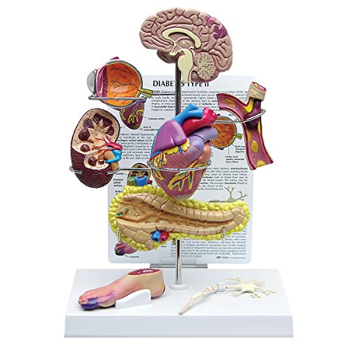 GPI Anatomicals W33386 Diabetes Modell, mini Set, 4 Stück GPI Anatomicals W33386 Diabetes Modell, mini Set, 4 Stück von GPI Anatomicals