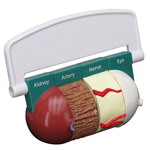 GPI Anatomicals W33387 Diabetes Scheibenmodell GPI Anatomicals W33387 Diabetes Scheibenmodell von 3B Scientific