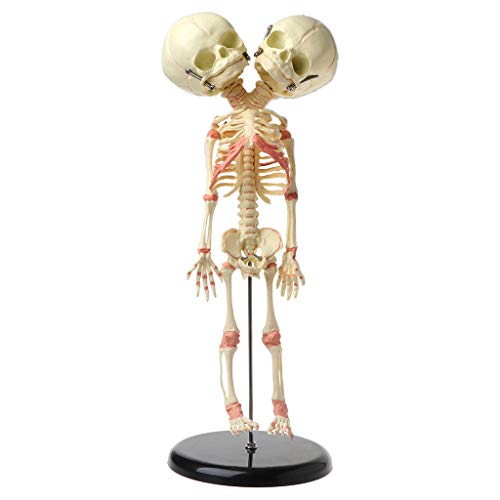 GUMEI 37cm Mensch Doppelkopf Baby Schädel Skelett Anatomie Gehirn Display Studie Lehre Anatomisches Modell von GUMEI