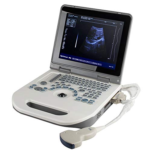 Tragbarer digitaler Laptop-Scanner mit 12,1-Zoll-LED-Bildschirm, Multi-Frequenz-Konvex-Technologie, Batterie im Lieferumfang enthalten von Generisch