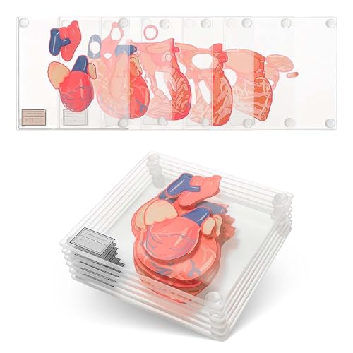 Untersetzer mit anatomischem Gehirn (Set mit 10 Stück) – Herz-Untersetzer-Set auch erhältlich Herz-Untersetzer. von Generix Geek