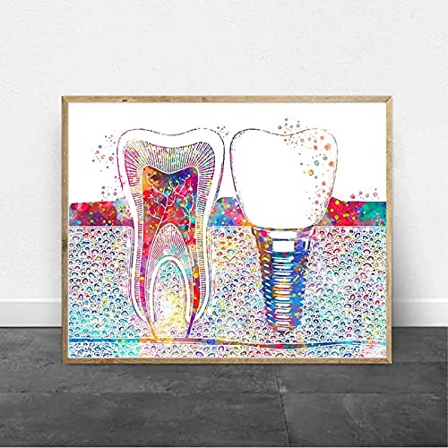 Leinwanddruck Dental Zahnimplantat Zahnarzt Wandkunst Bild Medizin Hygieniker Poster Zahn Aquarell Klinik Dekoration 50x70cm (20x28in) Rahmenlos von Guying Art