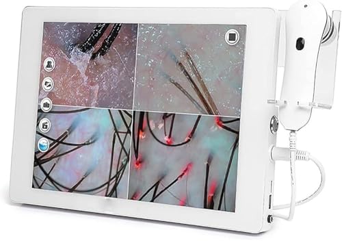 Kopfhautdetektor, Haaranalysegerät zur Hautdiagnose, hochauflösender Touchscreen, konfigurierbare Doppellinse, 32g großer Speicher, zur Erkennung des Gesundheitszustands von Haut und Haar. von HGAYUBDV