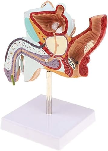 ININOSNP Anatomisches Modell der männlichen Geschlechtsorgane Anatomisches Modell der männlichen urologischen Erkrankungen for medizinische Lehrmittel ININOSNP Anatomisches Modell der männlichen Geschlechtsorgane Anatomisches Modell der männlichen urologischen Erkrankungen for medizinische Lehrmittel von ININOSNP