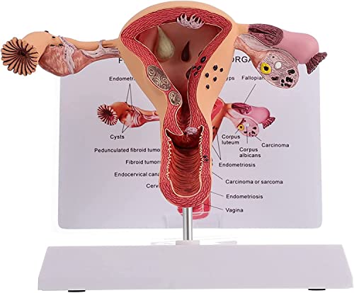 1Pc Female Reproductive Organs Anatomy Model Uterus Model, Pathological Uterus and Ovary Anatomical Model - Human Female Medical Anatomy von KHSASDDC