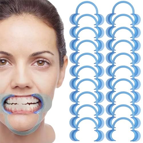 C-Form Mundöffner,20 Stück Dental C-Form Mundöffner,Mundöffner Challenge,Wangenhalter,Mundwinkelhalter,für Orale Untersuchung, Behandlung, Zahnaufhellung von KLLJ