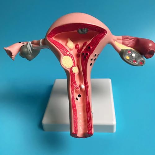 1 stück Menschlichen Pathologischen Gebärmutter Eierstock Modell Querschnitt Struktur Modell Gebärmutter Anatomische Anatomie Weibliche Organe Lehren Studie Werkzeug 1 stück Menschlichen Pathologischen Gebärmutter Eierstock Modell Querschnitt Struktur Modell Gebärmutter Anatomische Anatomie Weibliche Organe Lehren Studie Werkzeug von KXJSYL Tool