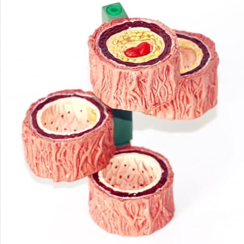 1pc 4-Bühne Menschliche Arterie Blutgefäß Anatomie Modell Medizinische Wissenschaft Lehre Ressourcen Dropshipping von KXJSYL Tool