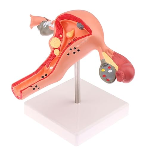 KXJSYL Tool 1Pc Medizinische Requisiten Modell Pathologischen Gebärmutter Eierstock Anatomisches Modell Anatomie Querschnitt Studie Werkzeug KXJSYL Tool 1Pc Medizinische Requisiten Modell Pathologischen Gebärmutter Eierstock Anatomisches Modell Anatomie Querschnitt Studie Werkzeug von KXJSYL Tool
