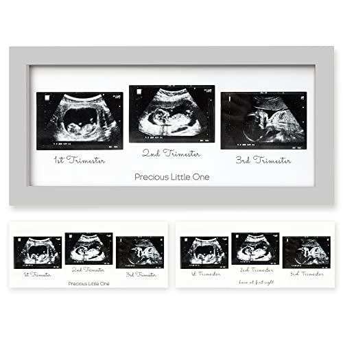 Trio Baby Bilderrahmen für Ultraschallbilder - Bilderrahmen Ultraschallbild Baby, Ultraschall Bilderrahmen Schwangerschaft, Ultraschallbilder Rahmen, Geschenke für Werdende Mamas (Cloud Gray) von KeaBabies
