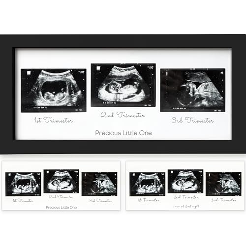 Trio Baby Bilderrahmen für Ultraschallbilder - Bilderrahmen Ultraschallbild Baby, Ultraschall Bilderrahmen Schwangerschaft, Ultraschallbilder Rahmen, Geschenke für Werdende Mamas (Onyx Black) von KeaBabies