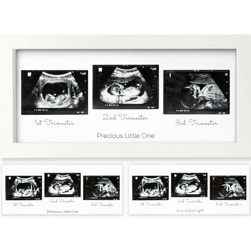 Trio Baby Bilderrahmen für Ultraschallbilder - Bilderrahmen Ultraschallbild Baby, Ultraschall Bilderrahmen Schwangerschaft, Ultraschallbilder Rahmen, Geschenke für Werdende Mamas (Alpine White) von KeaBabies