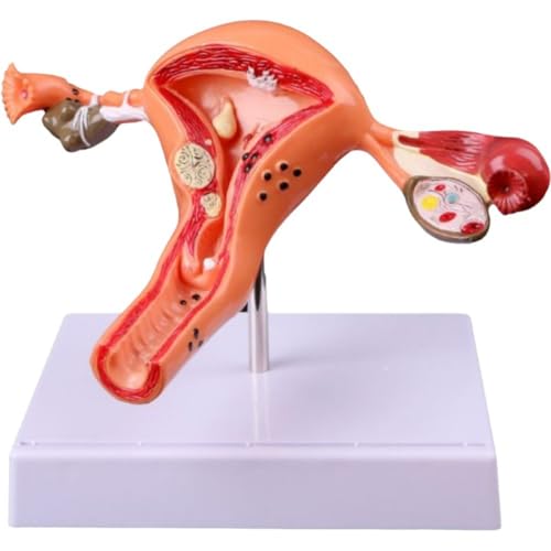 Keuyeo Uterus-eierstock-Modell, Pathologisches Uterus-eierstock-anatomisches Modell, Anatomie-querschnitt-studienwerkzeug, Medizinisches Requisiten-Modell Keuyeo Uterus-eierstock-Modell, Pathologisches Uterus-eierstock-anatomisches Modell, Anatomie-querschnitt-studienwerkzeug, Medizinisches Requisiten-Modell von Keuyeo