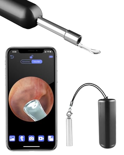 Ohrenschmalz Entferner-Wifi Otoskop,D10 HD Ohrenreiniger mit Licht und 8 Ohrlöffeln, Ohrreiniger Set Ohrenschmalz Entfernen mit Aufbewahrungsbox für iPhone, iPad & Android Smartphones von Kouric