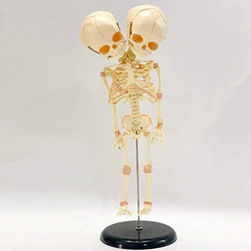 LBYLYH Baby-Skelett-Modell Mensch - Anatomisches Modell Skelett Neugeborene Fetale Missbildungen Doppelkopf von LBYLYH