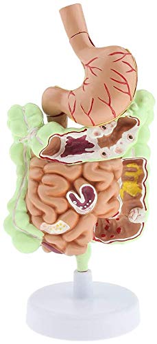 LBYLYH Modell Der Menschlichen Anatomie Verdauungstrakt In Der Größe Natürlich, Studio Unterricht LBYLYH Modell Der Menschlichen Anatomie Verdauungstrakt In Der Größe Natürlich, Studio Unterricht von LBYLYH