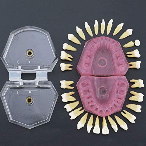 LMEIL Zahnimplantat-Zahnmodell Komplettes Zahnzahnmodell Mit 28-teiligen Abnehmbaren Zähnen Und Weichem Zahnfleisch Standard-Typodont-Studie Unterrichten Sie Das Standardmodell Für Die Medizin von LMEIL