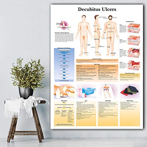 Ling88 Bilder, Poster, Gemälde, Dekubitus-Geschwür-Diagramm-Kunst- Poster-Druck Body Map Leinwand-Wandbilder Für Die Medizinische Ausbildung Wohnkultur Poster Und Drucke - 50X70Cm von Ling88