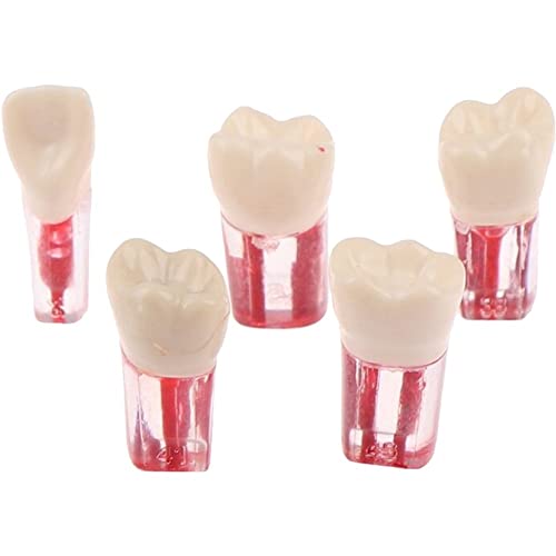 5 Stücke Harz Dental Endodontie Zahn Modell Endo Wurzelkanal Dateien Zellstoff Praxis Studie Endo Ausbildung Zahn RCT Demo Student Lehre 5 Stücke Harz Dental Endodontie Zahn Modell Endo Wurzelkanal Dateien Zellstoff Praxis Studie Endo Ausbildung Zahn RCT Demo Student Lehre von Lpitoy