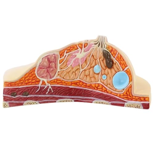Luxylei Pathologischer Brustquerschnitt, Anatomisches Modell, Lehr- Und Trainingshilfe, Weibliche Brust, Anatomisches Modell Für Brustchirurgen, Geschenk Luxylei Pathologischer Brustquerschnitt, Anatomisches Modell, Lehr- Und Trainingshilfe, Weibliche Brust, Anatomisches Modell Für Brustchirurgen, Geschenk von Luxylei