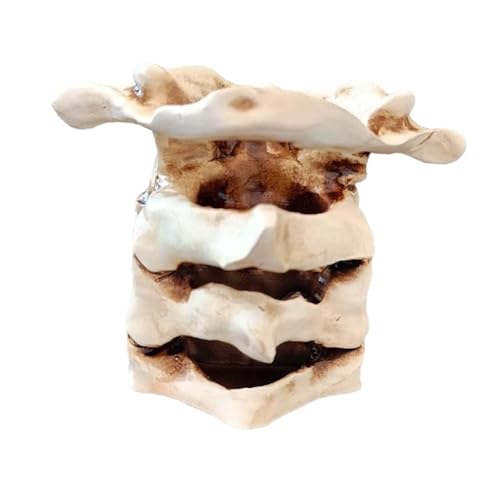 MERIGLARE Simulation Wirbelsäule Vase Desktop Ornament Blume Vase Wirbelsäule Statue Home Kunst Dekoration von MERIGLARE