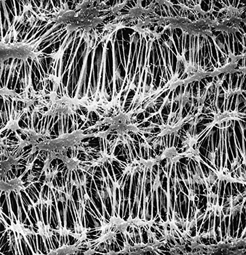 MILLIPORE 053785 Filtre membrane Omnipore porosité 1 µm (Pack de 25) von Millipore