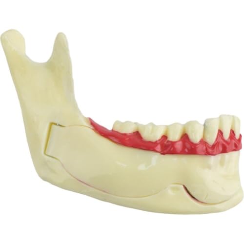 Dental Endodontie Behandlung Modell Unterkiefergewebe Anatomisches Modell Anatomie des Zahnfleisches Zahnmedizin Studie Mundpflege Zähne Lehren Modell von Muteitt
