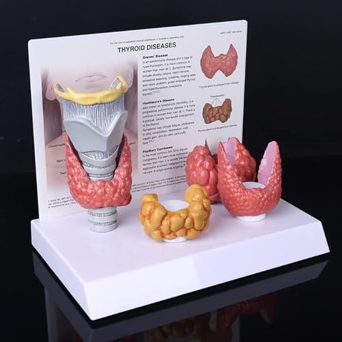 NURCIX Menschliche Schilddrüse Modell, 3:1 Zeigen der Schilddrüse pathologischen Verdauungssystem Display Studie menschlichen Körper anatomisches Modell Lehrmittel von NURCIX