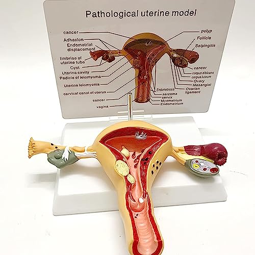 Pathologisches Modell Des Weiblichen Fortpflanzungssystems, Simulation Der Menschlichen Körper-Uterus-Eierstock-Vaginal-Anatomie, Modell Weiblicher Organe Für Geburtshilfliche Lehrmittel, Lehrmittel von NVYAZJ