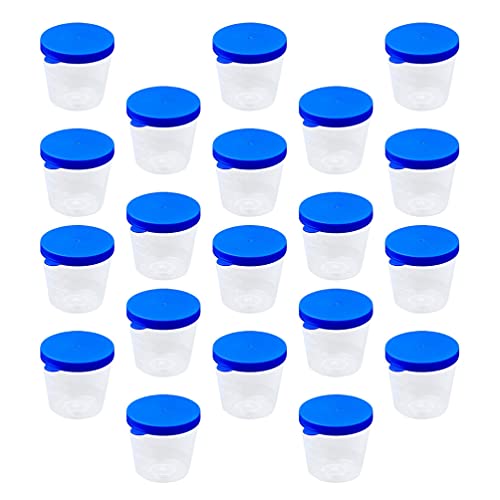 POPETPOP Probenbehälter Probe : 100 Stück - Sputum- Sammlung Tasse Urinbehälter Schwangerschaftstest für Laborkrankenhaus Safe Pee Proben Sammlung Tests 40 Ml Testbecher von POPETPOP