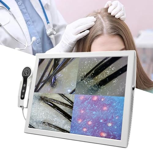 Hautgesundheitsanalysator Mit 15-Zoll-Touchscreen, Automatische Hautdiagnose Mit 70x/200x HD-Kamera, Speicherfunktion Für 1000+ Bilder 18 Millionen Pixel Für Den Salon Zu Hause Hautgesundheitsanalysator Mit 15-Zoll-Touchscreen, Automatische Hautdiagnose Mit 70x/200x HD-Kamera, Speicherfunktion Für 1000+ Bilder 18 Millionen Pixel Für Den Salon Zu Hause von SSQUZA