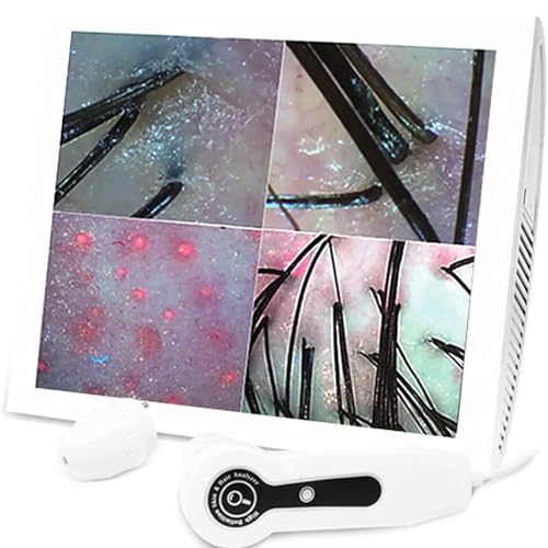 SSQUZA HochauflöSende Haut-Haarerkennung, 15-Zoll-LCD-Bildschirm, Digital, Austauschbare 200-Fache/70-Fache VergrößErung, Speicherfunktion für 1000+ Bilder FüR Den Einsatz Im Heimsalon SSQUZA HochauflöSende Haut-Haarerkennung, 15-Zoll-LCD-Bildschirm, Digital, Austauschbare 200-Fache/70-Fache VergrößErung, Speicherfunktion für 1000+ Bilder FüR Den Einsatz Im Heimsalon von SSQUZA