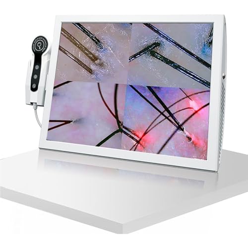 SSQUZA Intelligentes All-in-One-Gerät zur Haut 70X / 200x Kopfhautdetektor-Scanner, Kopfhaut Haarfollikelöl Feuchtigkeitsvergrößerender Detektor, Mit 15 Zoll HD-Bildschirm, Vier-Teil-Vergleich von SSQUZA