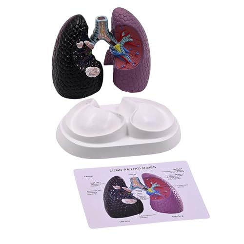 Realistische Lungenanatomie Modell Anatomischer Menschlicher Lehrwerkzeug Und Pathologische Anatomie Gesundheitserziehung Ausrüstung Realistische Lungenanatomie Modell Anatomischer Menschlicher Lehrwerkzeug Und Pathologische Anatomie Gesundheitserziehung Ausrüstung von TENYELE