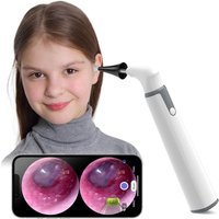 Otoskop, ultradünnes kabelloses HD-Otoskop mit Licht, Ohrenreiniger mit Temperaturregelung und Gyroskop, Ohren-Endoskop, kompatibel mit Android von TREETALK
