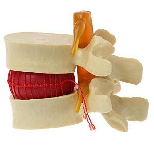 TsoLay Lenden Wirbel Modell Anatomische Wirbel SäUle Lenden Wirbel Scheiben Vorfall Anatomie Lehrmittel Lenden Wirbel Modell TsoLay Lenden Wirbel Modell Anatomische Wirbel SäUle Lenden Wirbel Scheiben Vorfall Anatomie Lehrmittel Lenden Wirbel Modell von TsoLay