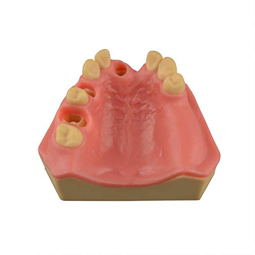 Ultrassist Zahnimplantat Training Praxis Maxillarmodell mit Sinus, Basic Implantat Training Modell mit Übung Weiches Zahnfleisch, Großartiger Zahntrainingszahn für Zahnimplantat Praxis Ultrassist Zahnimplantat Training Praxis Maxillarmodell mit Sinus, Basic Implantat Training Modell mit Übung Weiches Zahnfleisch, Großartiger Zahntrainingszahn für Zahnimplantat Praxis von Ultrassist