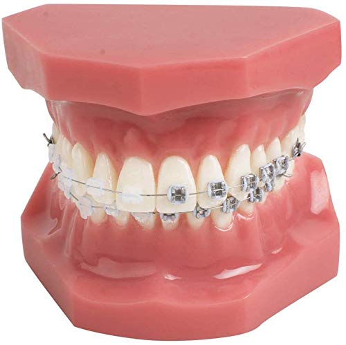 Vinbcorw Unterstützt Zahnmodell, TipoDonto Dental mit geistigen Klammern Kieferorthopädie Zähne Modellbehandlung mit Ligature Red Tie, mit Anti-Nagel-Lehrmodell,Rot von Vinbcorw