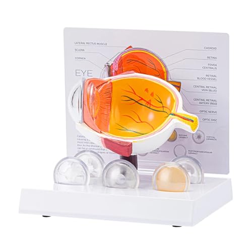 Menschliches Anatomisches Augenmodell Realistische Pathologische Augapfelanatomie Zum Unterrichten Von Demonstration Und Pädagogischer Verwendung PVC Augapfel Menschliches Anatomisches Augenmodell Realistische Pathologische Augapfelanatomie Zum Unterrichten Von Demonstration Und Pädagogischer Verwendung PVC Augapfel von WKabnkn