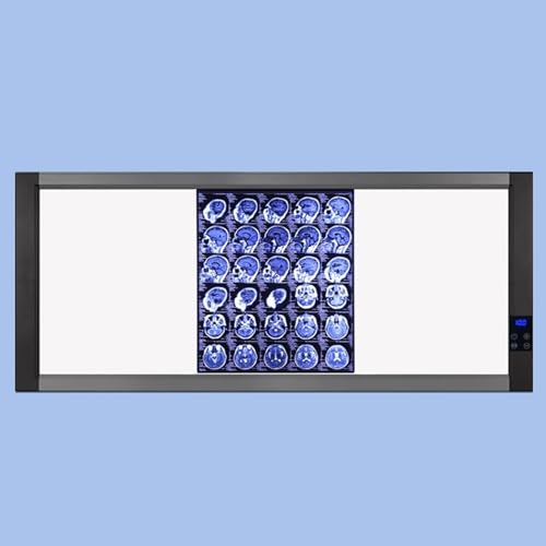 Professionelle Röntgenfilm Leuchtbox, Smart Touch LED Röntgen Sichtbox mit Halterung und Optischem Acryl Diffusor für den Heim und Laborgebrauch(127x51cm/50x20in) von WNGJZZYC