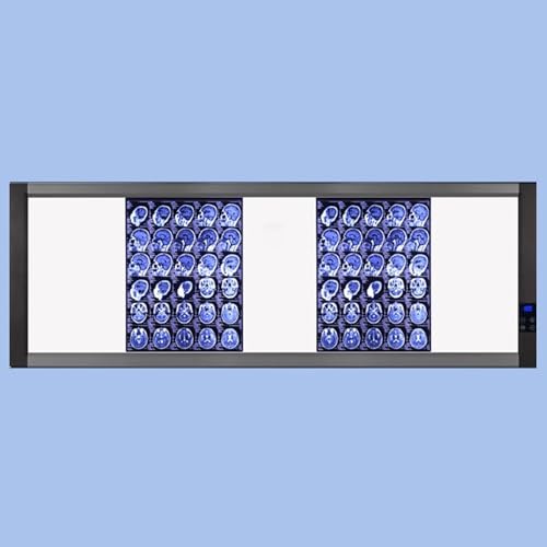 Professionelle Röntgenfilm Leuchtbox, Smart Touch LED Röntgen Sichtbox mit Halterung und Optischem Acryl Diffusor für den Heim und Laborgebrauch(167x51cm/66x20in) von WNGJZZYC