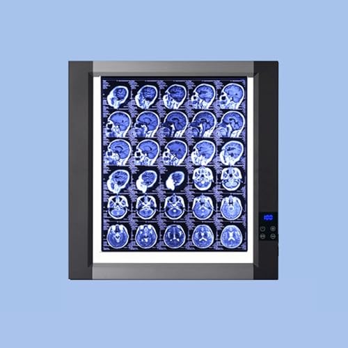 Professionelle Röntgenfilm Leuchtbox, Smart Touch LED Röntgen Sichtbox mit Halterung und Optischem Acryl Diffusor für den Heim und Laborgebrauch(47x51cm/18.5x20in) von WNGJZZYC