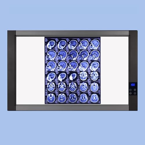 Professionelle Röntgenfilm Leuchtbox, Smart Touch LED Röntgen Sichtbox mit Halterung und Optischem Acryl Diffusor für den Heim und Laborgebrauch(87x51cm/34x20in) von WNGJZZYC