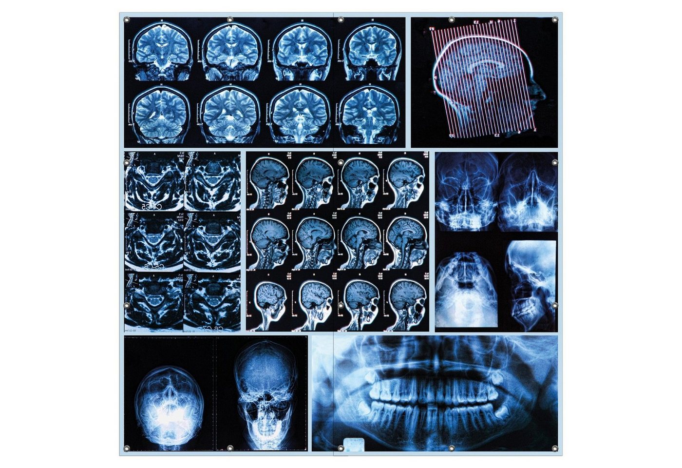 Wallario Sichtschutzzaunmatten Röntgen-Bilder eines menschlichen Kopfes von allen Seiten, 2-teilig von Wallario