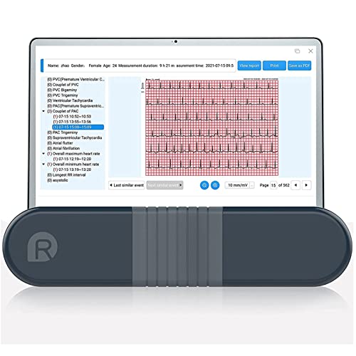 Wellue ER1 EKG Monitor, Professioneller Holter Recorder mit AI-EKG Analysebericht, 24 Std EKG Holter Aufzeichnung, Unterstützung für PC Software, Tragbarer Herzgesundheits-Tracker für den Heimgebrauch von Wellue