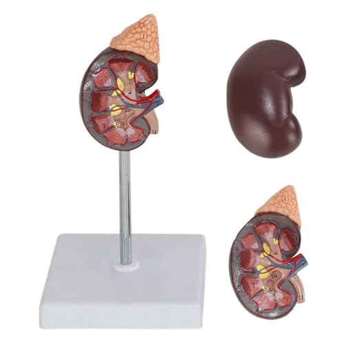 XDAWQP Pathologisches Modell der Niere mit normaler und pathologischer Anatomie, anatomisches Modell der menschlichen Niere zum Unterrichten von Modellen, zur Präsentation von Schreibtisch-Ornamenten von XDAWQP