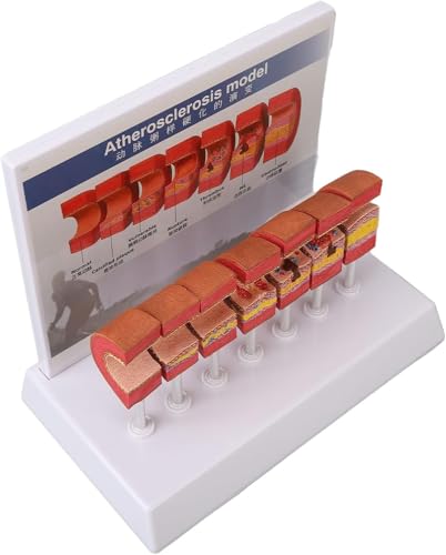 Anatomisches Replikatmodell, Arterienmodell des menschlichen Körpers mit Arteriosklerose, leuchtende Farben, Simulation for pädagogisches Werkzeug von Xinzhai